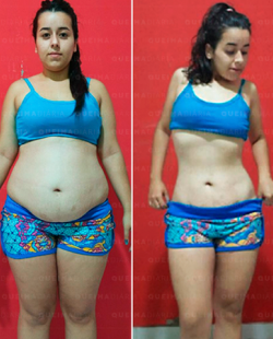 Vanessa Lara 21 anos, perdeu 12kg usando Queima Diária